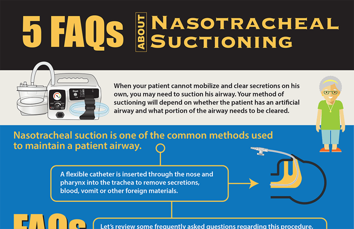 5-FAQs-about-nasotracheal-suctioning