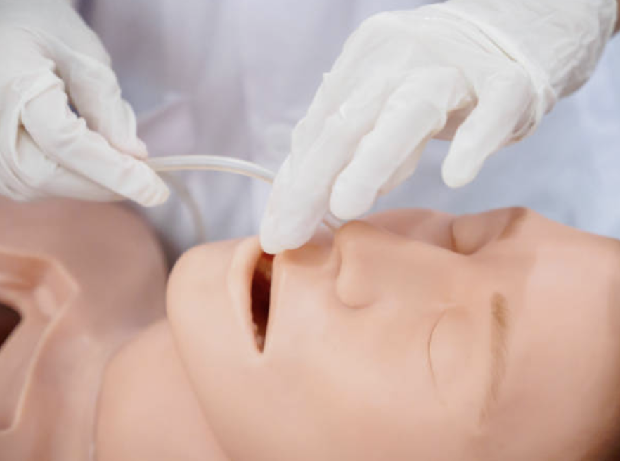 Nasopharyngeal Airway Complications