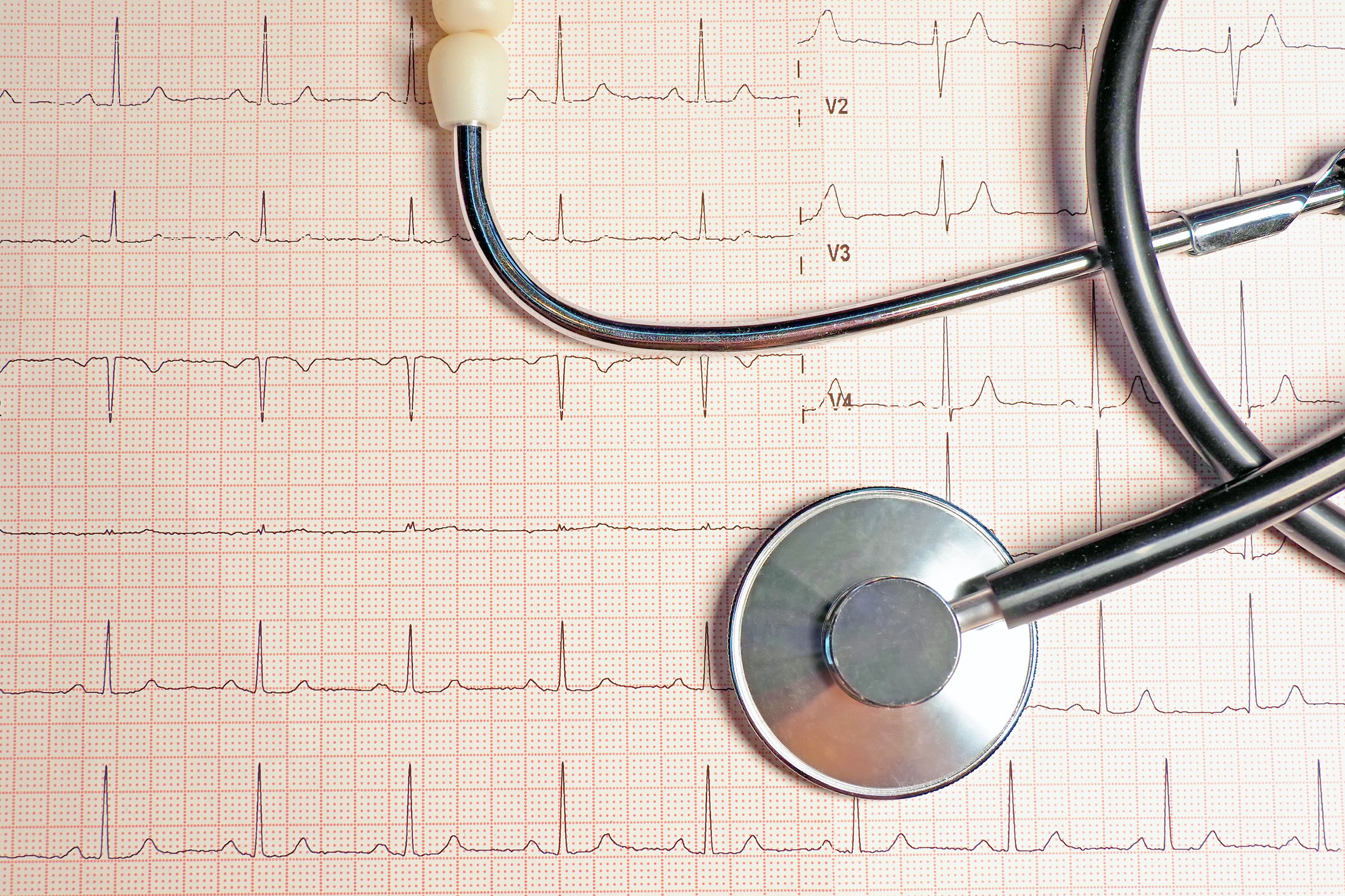 Suctioning a Patient with Tachycardia