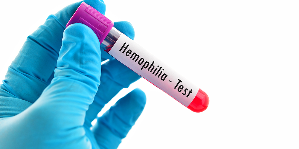 World Hemophilia Day: A Guide to the Disease and Airway Suctioning